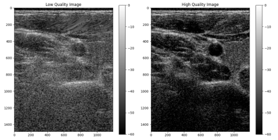Ultrasound Domain Adaptation